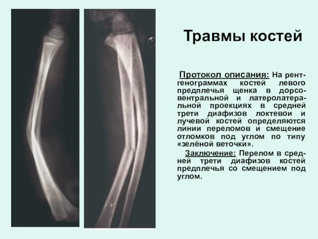Травмы костей Протокол описания: На рент-генограммах костей левого предплечья щенка