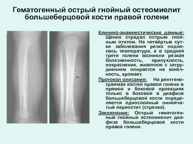 Гематогенный острый гнойный остеомиелит большеберцовой кости правой голени Клинико-анамнестические данные: Щенок страдал острым