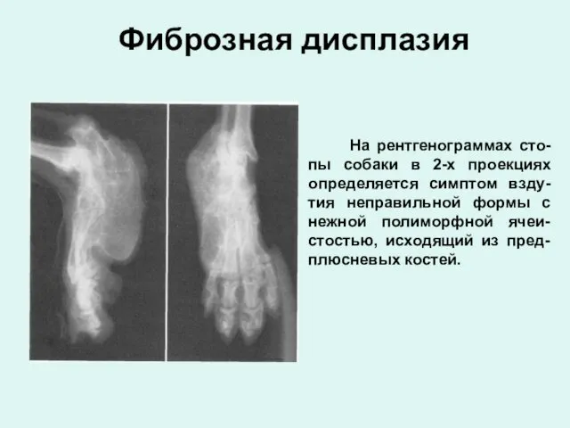 Фиброзная дисплазия На рентгенограммах сто-пы собаки в 2-х проекциях определяется