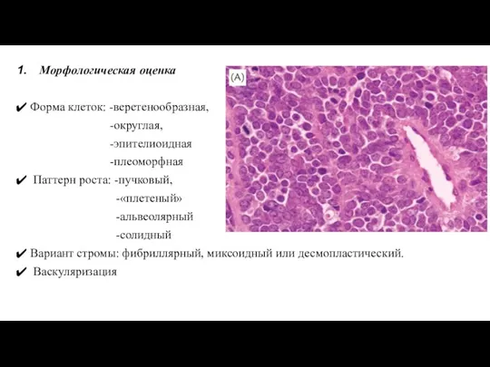 Морфологическая оценка Форма клеток: -веретенообразная, -округлая, -эпителиоидная -плеоморфная Паттерн роста: