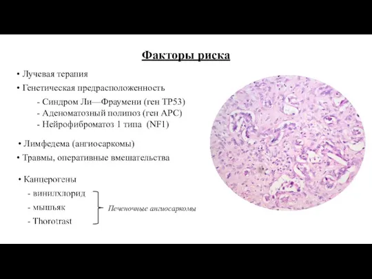 Факторы риска • Лучевая терапия • Генетическая предрасположенность Лимфедема (ангиосаркомы)