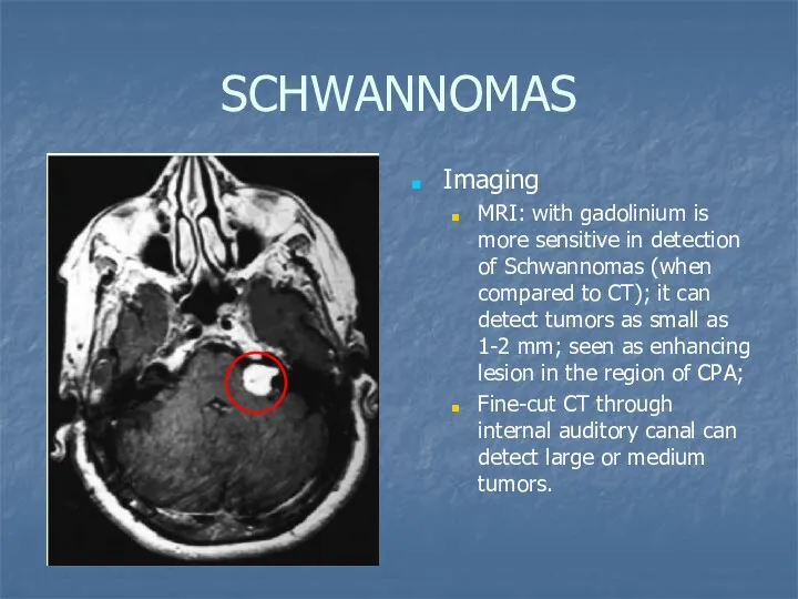 SCHWANNOMAS Imaging MRI: with gadolinium is more sensitive in detection of Schwannomas (when