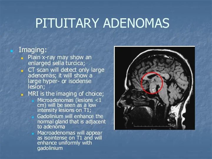 PITUITARY ADENOMAS Imaging: Plain x-ray may show an enlarged sella turcica; CT scan