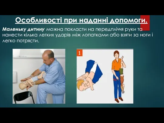 Особливості при наданні допомоги. Маленьку дитину можна покласти на передпліччя