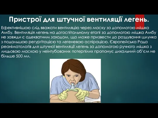 Пристрої для штучної вентиляції легень. Ефективнішою слід вважати вентиляцію через