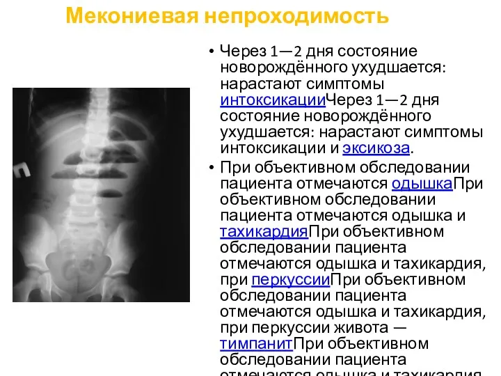 Мекониевая непроходимость Через 1—2 дня состояние новорождённого ухудшается: нарастают симптомы