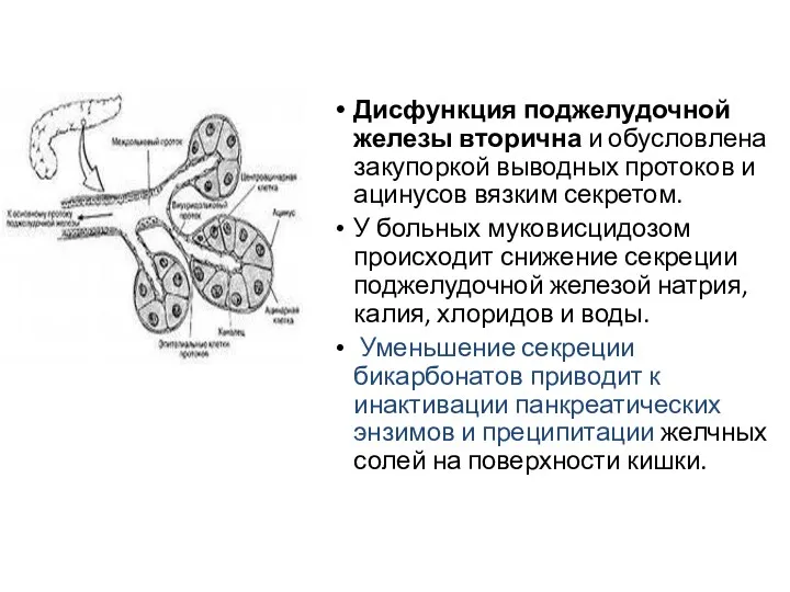 Дисфункция поджелудочной железы вторична и обусловлена закупоркой выводных протоков и