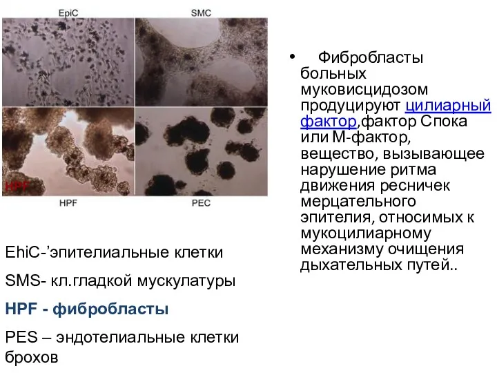 Фибробласты больных муковисцидозом продуцируют цилиарный фактор,фактор Спока или М-фактор, вещество,