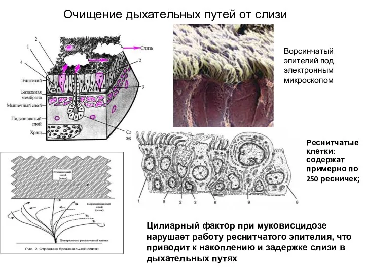 Ворсинчатый эпителий под электронным микроскопом Реснитчатые клетки: содержат примерно по