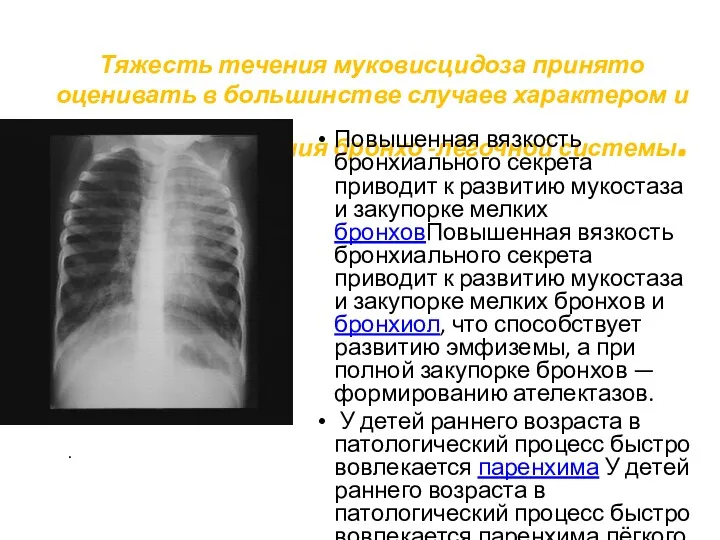 Тяжесть течения муковисцидоза принято оценивать в большинстве случаев характером и