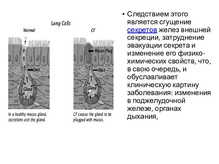 Следствием этого является сгущение секретов желез внешней секреции, затруднение эвакуации