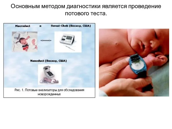 Основным методом диагностики является проведение потового теста.