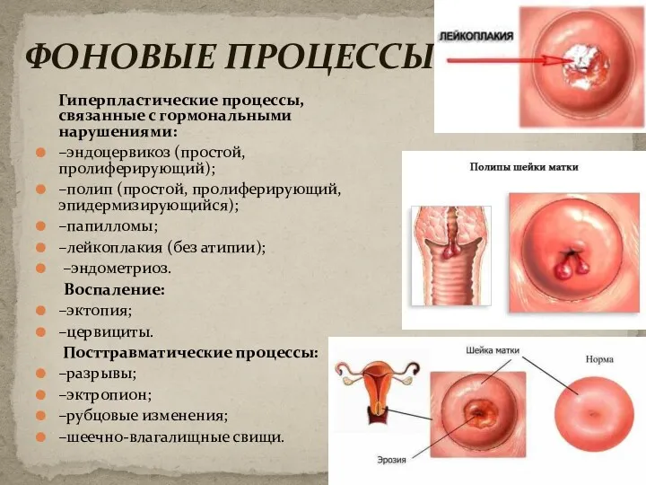 Гиперпластические процессы, связанные с гормональными нарушениями: –эндоцервикоз (простой, пролиферирующий); –полип