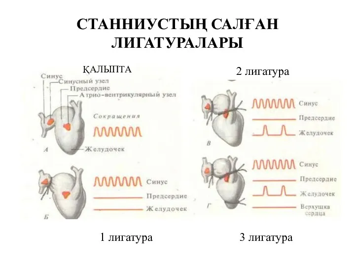 СТАННИУСТЫҢ САЛҒАН ЛИГАТУРАЛАРЫ ҚАЛЫПТА 1 лигатура 2 лигатура 3 лигатура