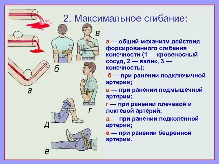 а — общий механизм действия форсированного сгибания конечности (1 —