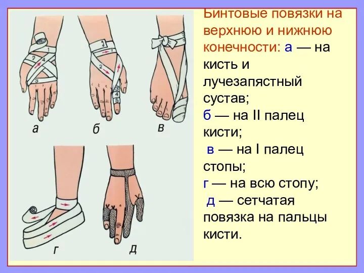 Бинтовые повязки на верхнюю и нижнюю конечности: а — на