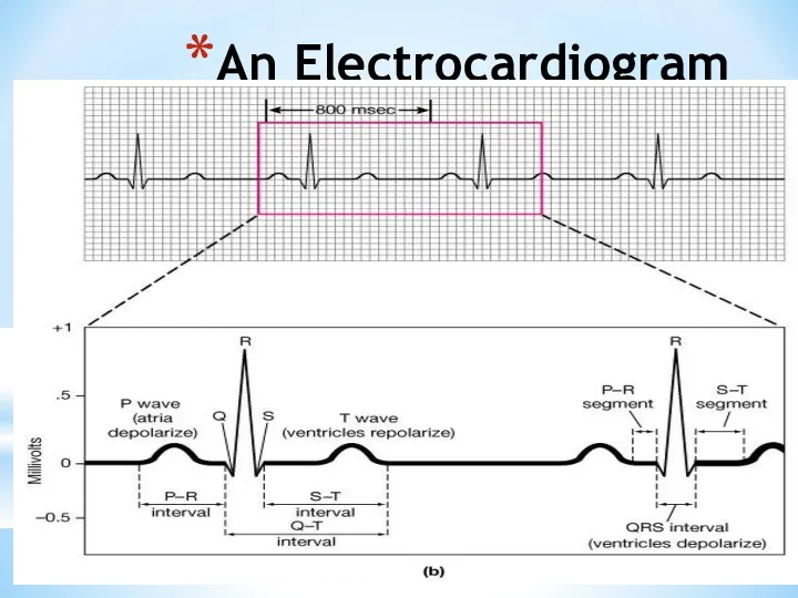 An Electrocardiogram