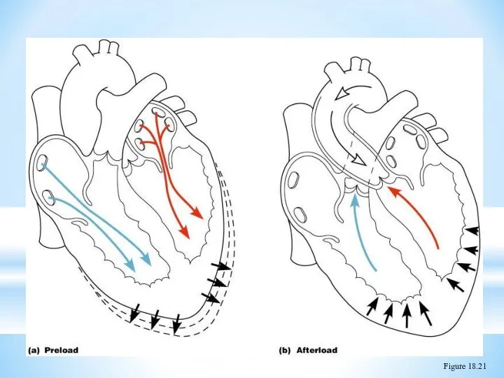 Preload and Afterload Figure 18.21