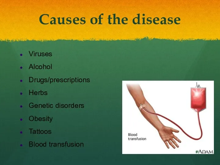 Causes of the disease Viruses Alcohol Drugs/prescriptions Herbs Genetic disorders Obesity Tattoos Blood transfusion