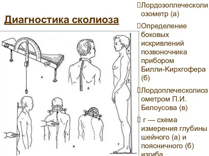 Диагностика сколиоза Лордозоплеческолиозометр (а) Определение боковых искривлений позвоночника прибором Билли-Kирхгофера