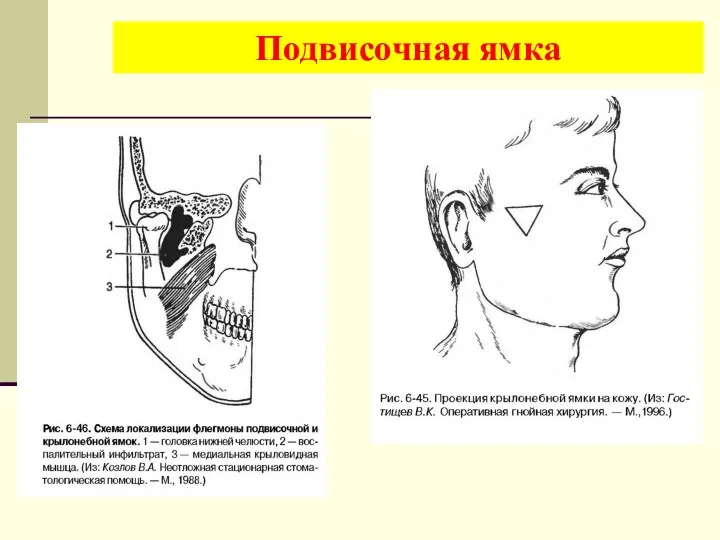 Подвисочная ямка