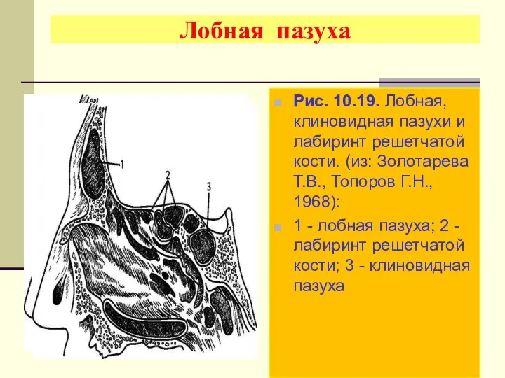 Лобная пазуха Рис. 10.19. Лобная, клиновидная пазухи и лабиринт решетчатой