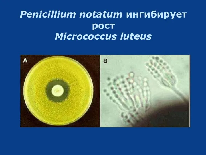 Penicillium notatum ингибирует рост Micrococcus luteus