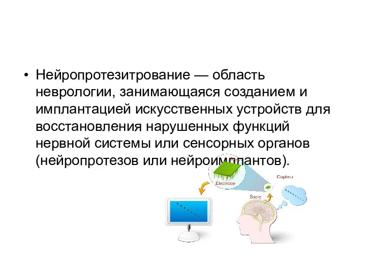 Нейропротезитрование — область неврологии, занимающаяся созданием и имплантацией искусственных устройств для восстановления нарушенных