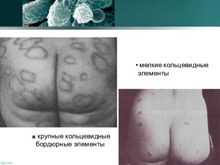 мелкие кольцевидные элементы крупные кольцевидные бордюрные элементы