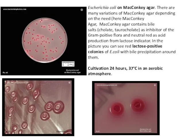 Escherichia coli on MacConkey agar. There are many variations of MacConkey agar depending
