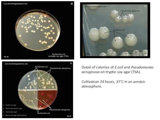 Detail of colonies of E.coli and Pseudomonas aeruginosa on tryptic soy agar (TSA).