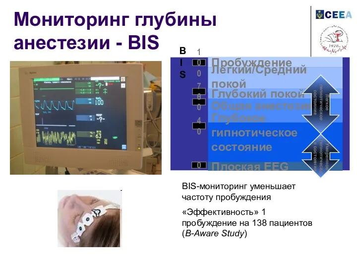 Мониторинг глубины анестезии - BIS BIS-мониторинг уменьшает частоту пробуждения «Эффективность»
