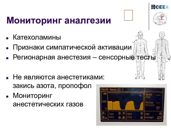 Мониторинг аналгезии Катехоламины Признаки симпатической активации Регионарная анестезия – сенсорные