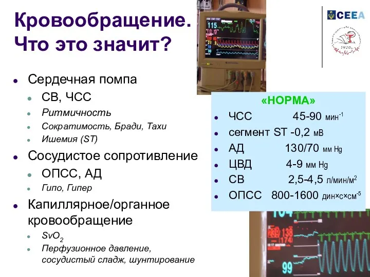 Кровообращение. Что это значит? Сердечная помпа СВ, ЧСС Ритмичность Сократимость,