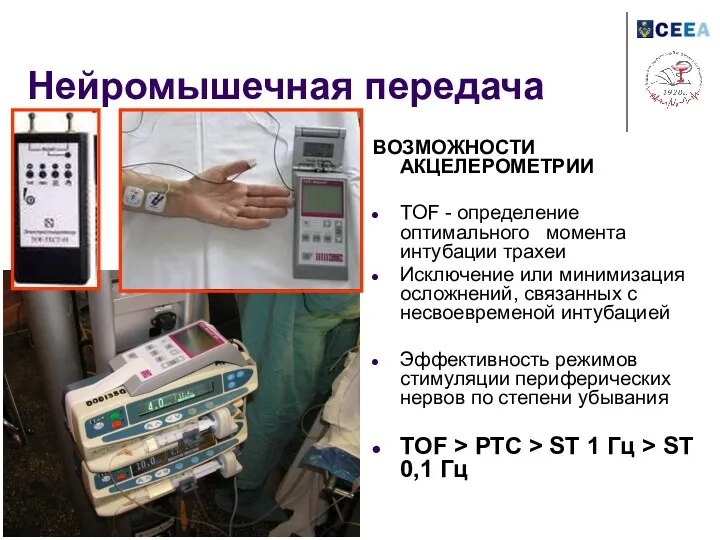 Нейромышечная передача ВОЗМОЖНОСТИ АКЦЕЛЕРОМЕТРИИ TOF - определение оптимального момента интубации