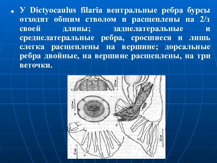 У Dictyocaulus filaria вентральные ребра бурсы отходят общим стволом и расщеплены на 2/з