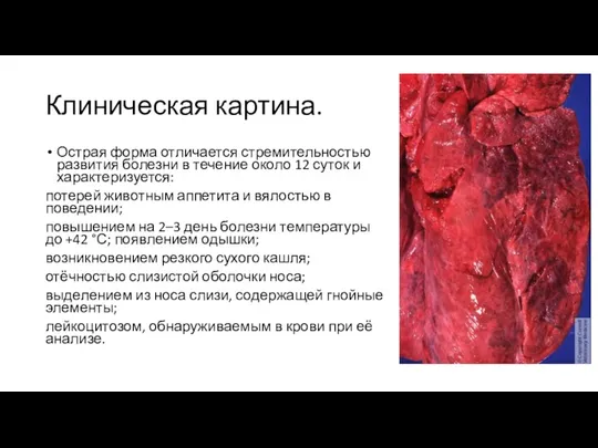 Клиническая картина. Острая форма отличается стремительностью развития болезни в течение