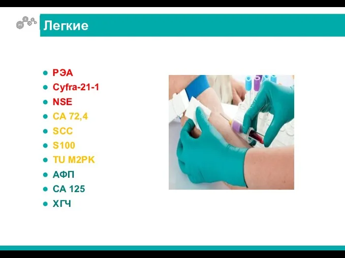 РЭА Cyfra-21-1 NSE СА 72,4 SCC S100 TU M2PK АФП СА 125 ХГЧ Легкие