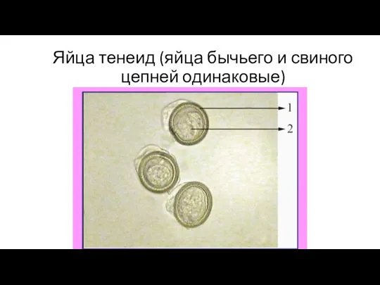 Яйца тенеид (яйца бычьего и свиного цепней одинаковые)