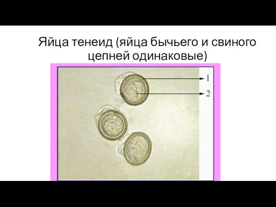 Яйца тенеид (яйца бычьего и свиного цепней одинаковые)