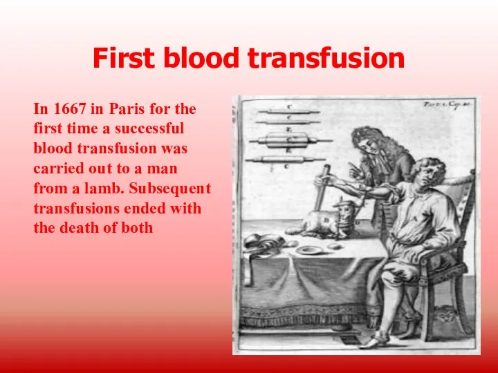 First blood transfusion In 1667 in Paris for the first