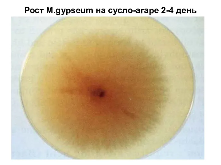 Рост М.gypseum на сусло-агаре 2-4 день