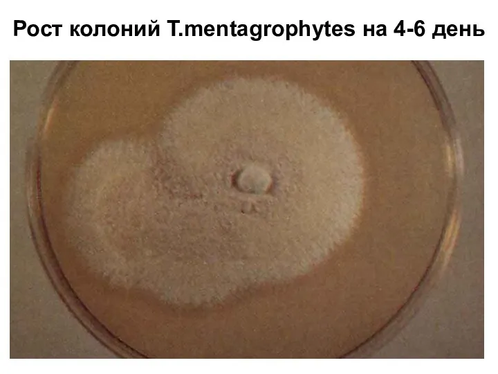 Рост колоний Т.mentagrophytes на 4-6 день