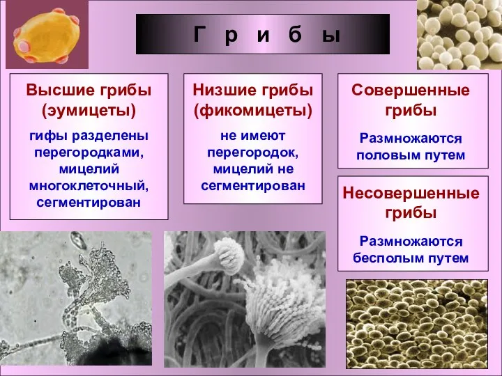 Г р и б ы Высшие грибы (эумицеты) гифы разделены