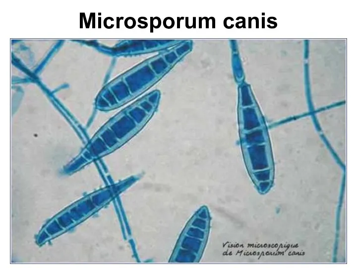 Microsporum canis