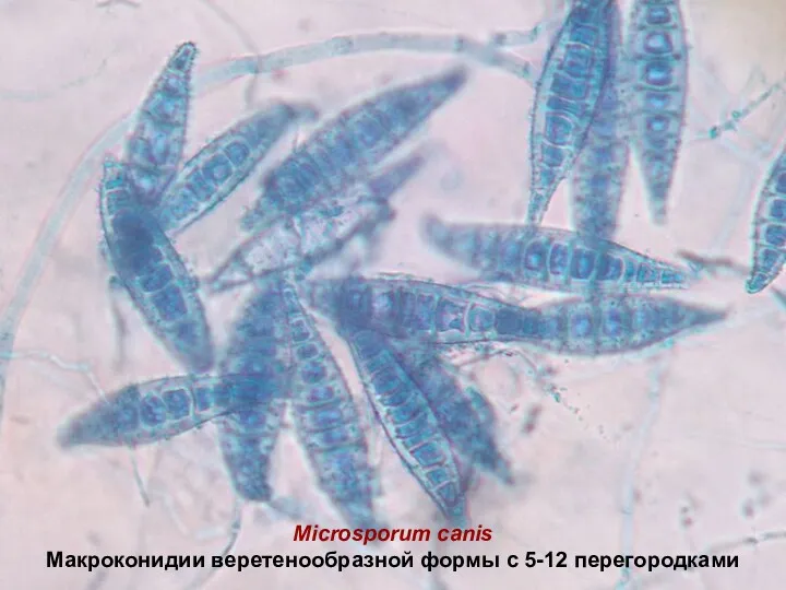 Microsporum canis Макроконидии веретенообразной формы с 5-12 перегородками