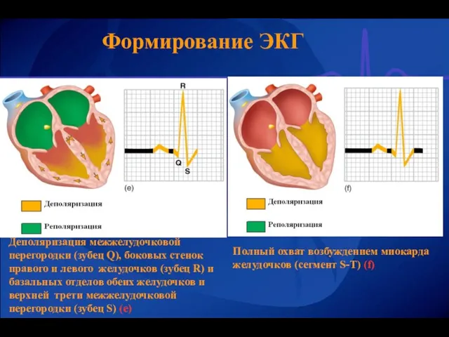 Формирование ЭКГ Деполяризация межжелудочковой перегородки (зубец Q), боковых стенок правого