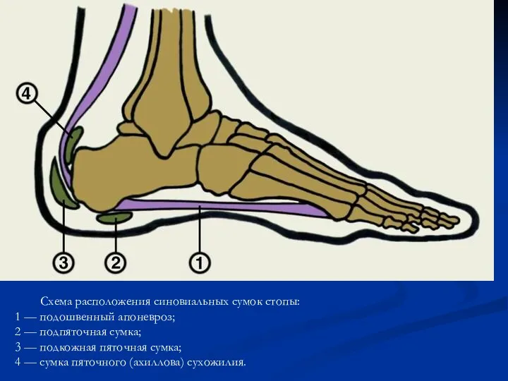 Схема расположения синовиальных сумок стопы: 1 — подошвенный апоневроз; 2 — подпяточная сумка;