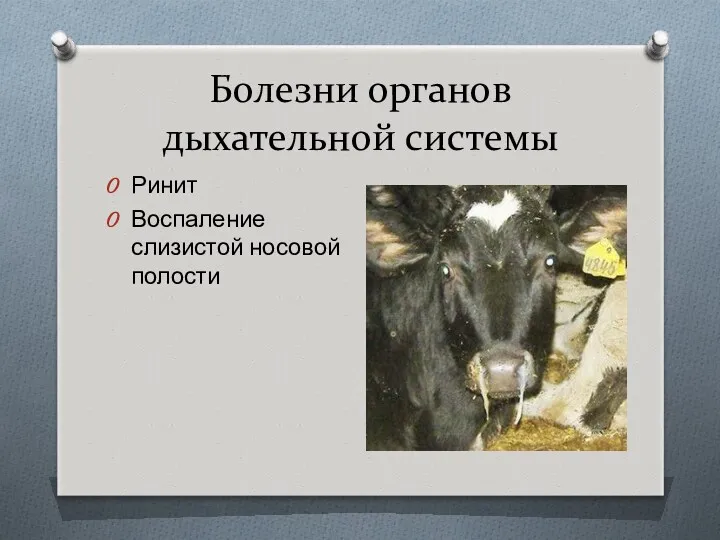 Болезни органов дыхательной системы Ринит Воспаление слизистой носовой полости