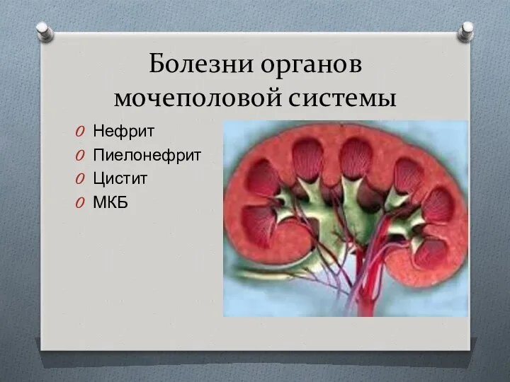 Болезни органов мочеполовой системы Нефрит Пиелонефрит Цистит МКБ